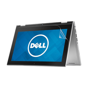 Dell Inspiron 11 3153 Vivid Screen Protector