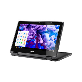 Dell Chromebook 11 3181 (Non-Touch) Matte Screen Protector