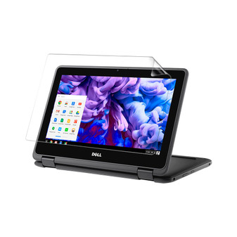 Dell Chromebook 11 3181 (Non-Touch) Silk Screen Protector