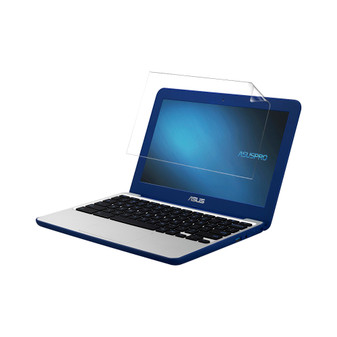 Asus Chromebook C202 Silk Screen Protector