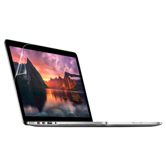 Apple Macbook Pro 15 A1398 (2014) Vivid Screen Protector