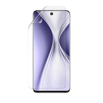 Honor X20 SE Silk Screen Protector