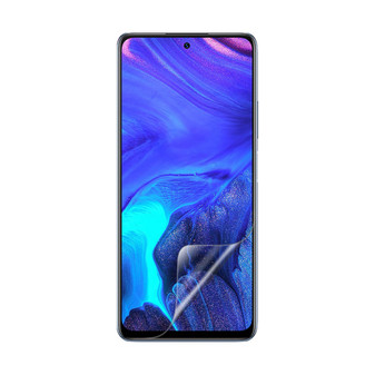 Infinix Note 10 Pro (2022) Vivid Screen Protector