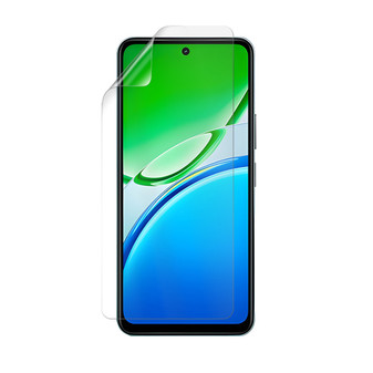 Vivo Y31 5G (2025)