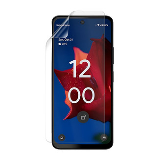 HMD M-Kopa
