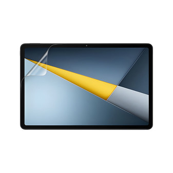 Xiaomi Poco Pad M1 Vivid Screen Protector