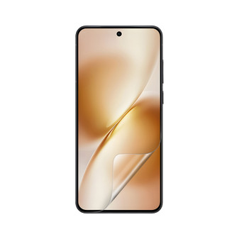 Vivo X200T Vivid Screen Protector