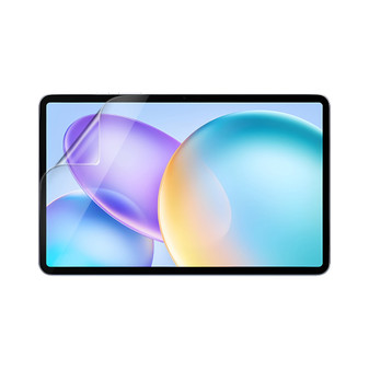 Infinix Xpad 20 Pro Matte Screen Protector