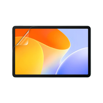 Infinix XPad 30E Vivid Screen Protector