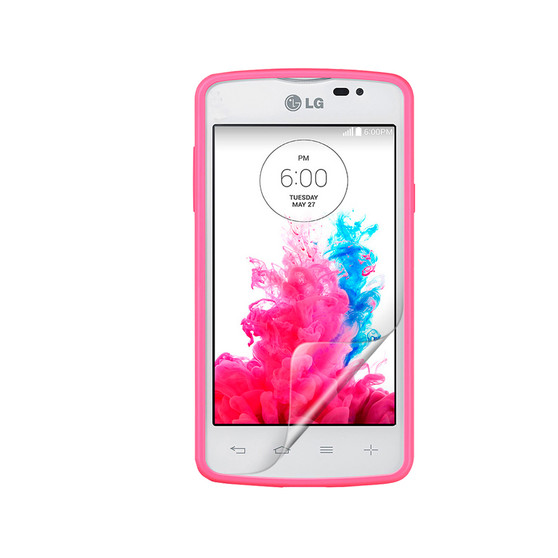 LG L50 Vivid Screen Protector