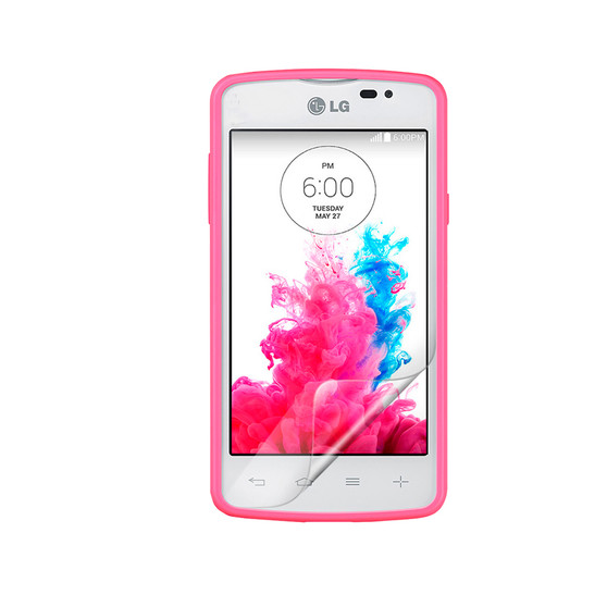 LG L50 Matte Screen Protector