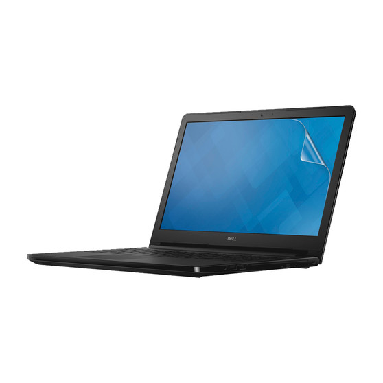 Dell Inspiron 15 5565 (Non-Touch) Vivid Screen Protector