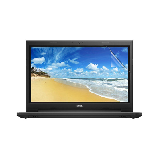 Dell Inspiron 15 3555 (Non-Touch) Vivid Screen Protector