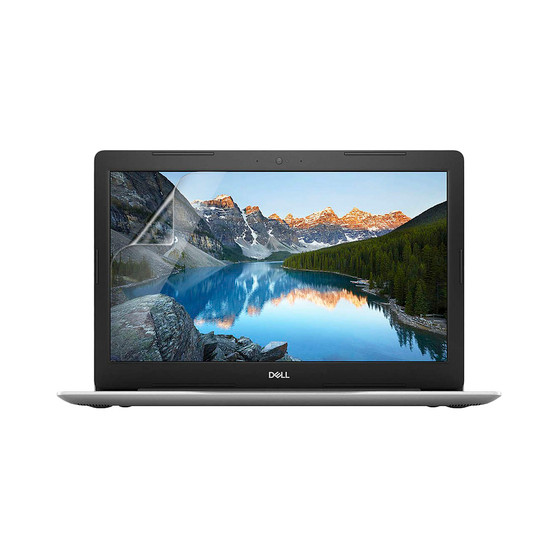 Dell Inspiron 15 5570 (Non-Touch) Matte Screen Protector