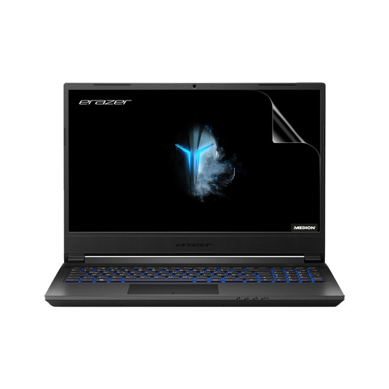 Medion ERAZER P15805 Vivid Screen Protector