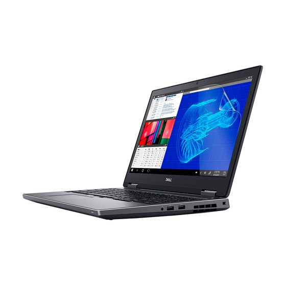 Dell Precision 15 7530 (Non-Touch) Matte Screen Protector