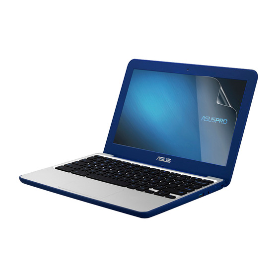 Asus Chromebook C202 Matte Screen Protector
