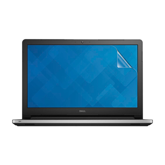 Dell Inspiron 15 5578 Vivid Screen Protector