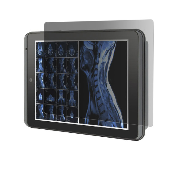 Arbor M0830 Privacy Quad Screen Protector