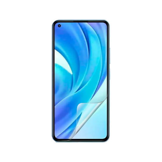 Xiaomi Mi 11 Lite Vivid Screen Protector