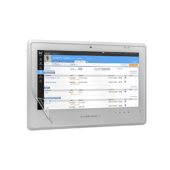 Cybernet CyberMed S20 Impact Screen Protector