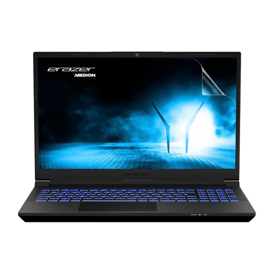 Medion Erazer Crawler E40 (15) Vivid Screen Protector