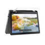 Dell Inspiron 15 7568 Silk Screen Protector