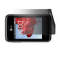LG L20 Privacy (Landscape) Screen Protector