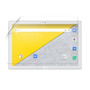 Archos T101 4G Silk Screen Protector