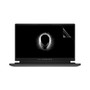 Dell Alienware M15 R5 Vivid Screen Protector