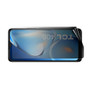 TCL 406i Privacy (Landscape) Screen Protector