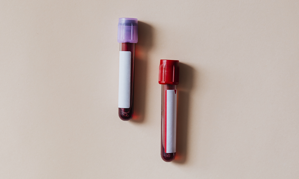imagen analíticas de sangre
