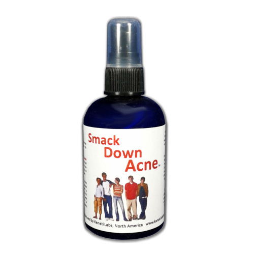Smack Down Acne Spray