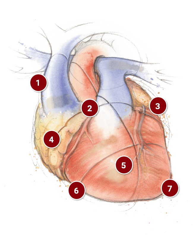 provex-heart.jpg