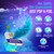 Water Flosser 3.0 with UV Mode Water Flosser & 24 Aquapods with Mouthwash for Fresh Breath