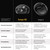 Eargo SE and Deep Cleaning Kit Bundle - Virtually Invisible Self-Fitting FDA-Cleared OTC CIC Hearing Aids - Rechargeable, Award-Winning Customer Support