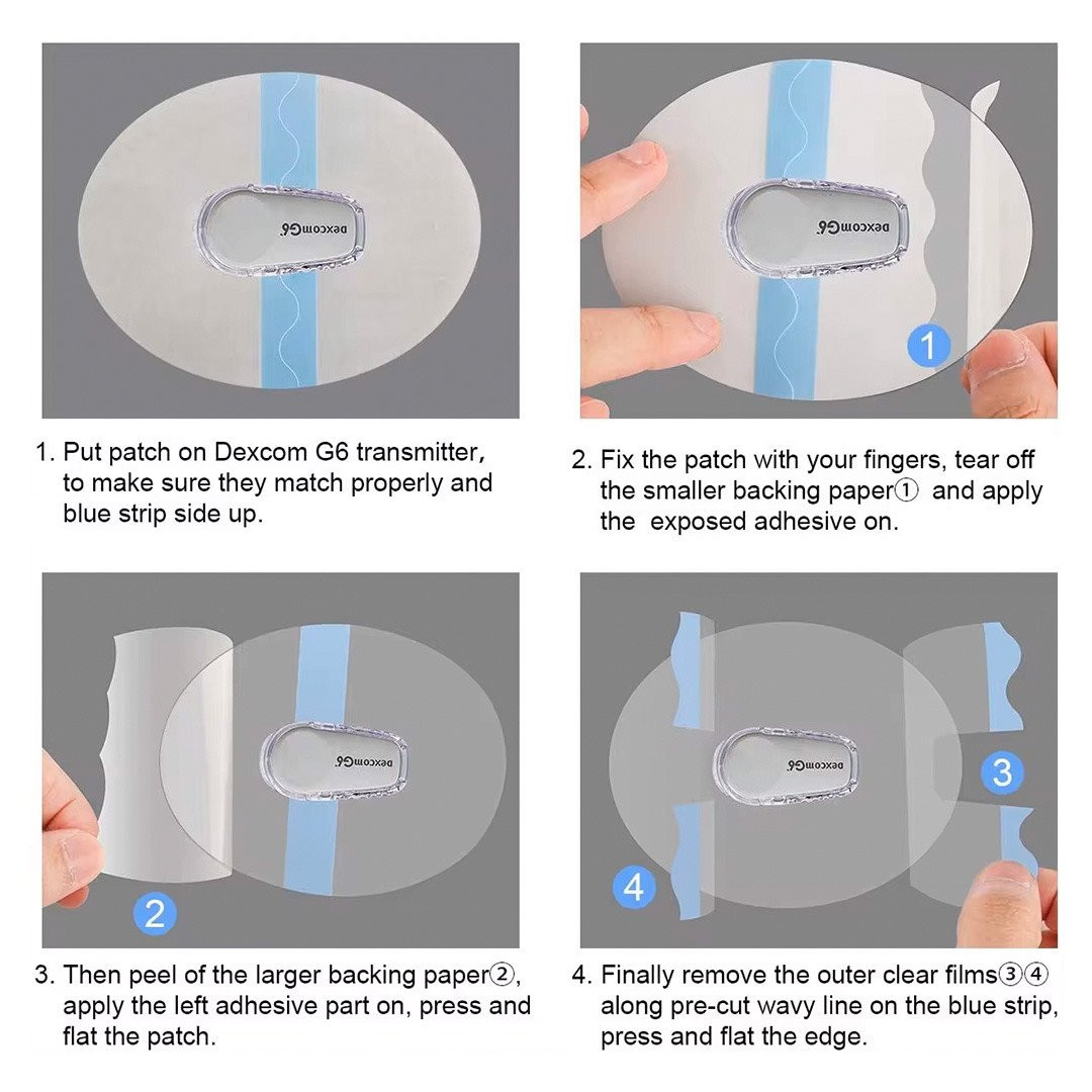 Overt Dexcom CGM Adhesive Patch - Transparent Waterproof [ 5 Pack ] For ...