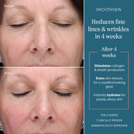 Best Way to Reduce or Remove Wrinkles