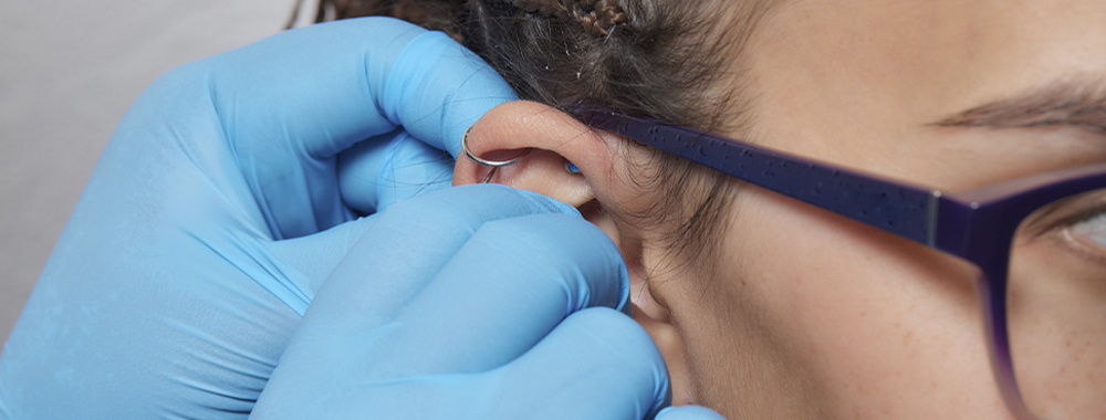 IMAGEN PERFORACIÓN LÓBULO 2 FARMACIA GARCÍA LAX