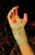 7  Wrist Brace W/Tension Strap Md Left 3 -3 1/2  Sporta B731-SA1374MDLT