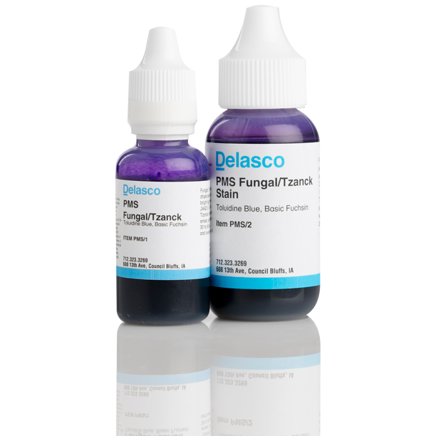 PMS Fungal Tzanck Stain