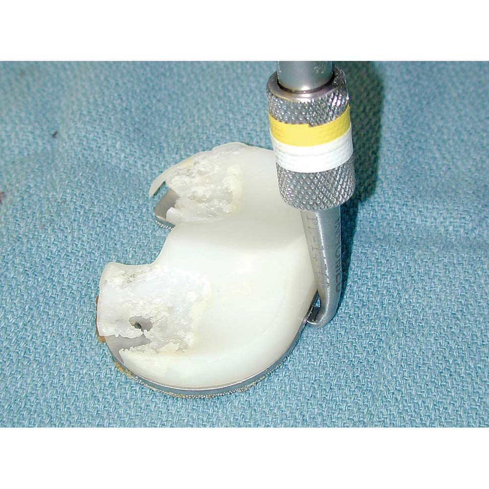 Gorski Tibia Tray Removal Hook-No Slaphammer | 101-365001