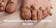 Where and How Antifungal Cream Can Be Used