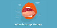 What is Strep Throat?