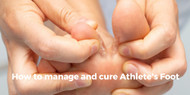 How to manage and cure Athlete's Foot?