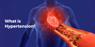 What is Hypertension?