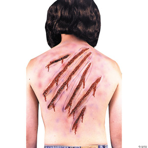 Nail scars N274-MR01FA99