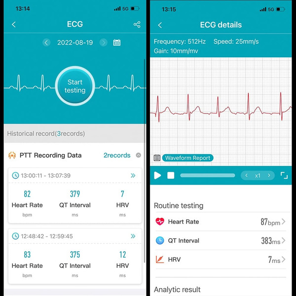 ET440 1.39-Inch Smart Watch Answer/Make Call Fitness Tracker with Heart Rate Blood Oxygen Sleep Mon K484-PEL_0QXZPHF1