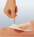 Impregnated Dressing Cuticerin 7.5 X 7.5 cm Gauze Cuticerin Ointment Sterile