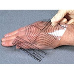 Wound Measuring Device Briggs MediRule 4.5 Inch X 6 Inch Plastic